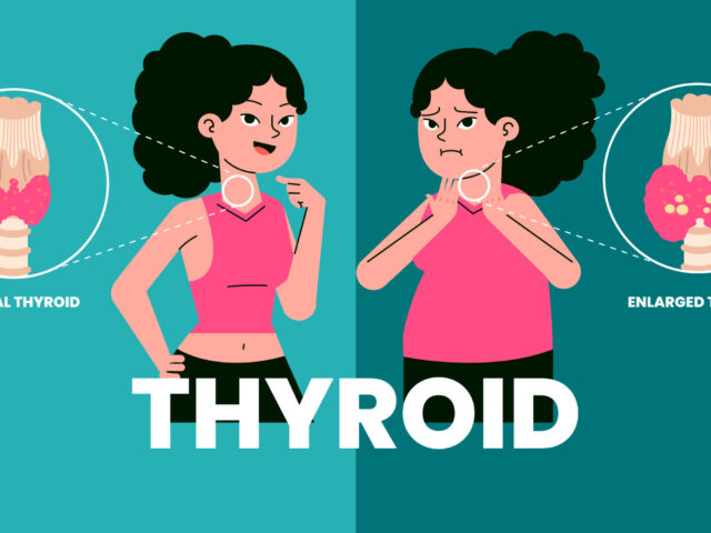 Hypothyroidism: Physiology, Medical Nutrition Therapy (MNT) & How Diet Supports Thyroid Health