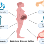 Gestational Diabetes Mellitus (GDM): Physiology, Nutritional Intervention & Long-Term Consequences